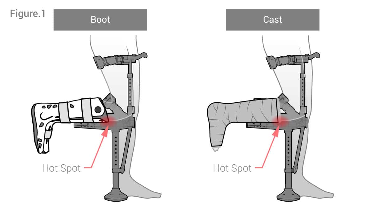 Is the iWALK Hands Free Crutch Right For You?